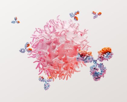 3D rendering of lupus